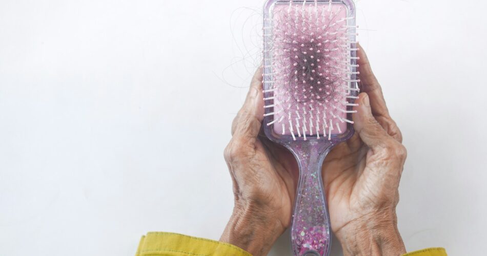 Diabetes dan Rambut Rontok: Mungkinkah Diabetes Menyebabkan Kebotakan?